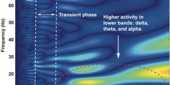 VR Time Warp: Brain Scans Reveal How Virtual Reality Distorts Time