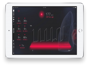 Big Data in iOS Charts case study 